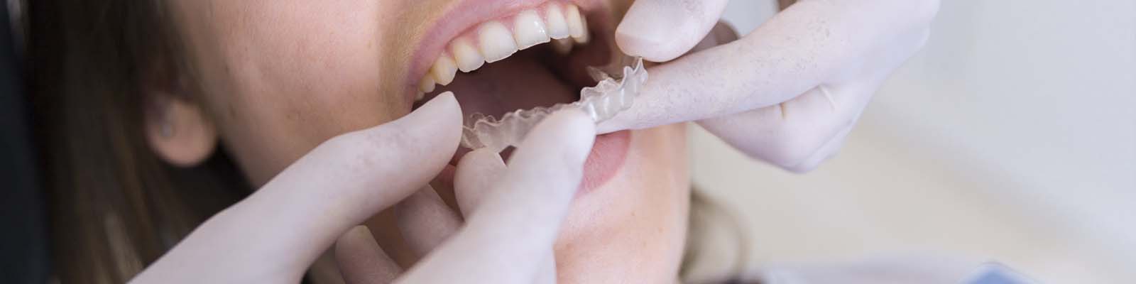 小石歯科 | 矯正治療